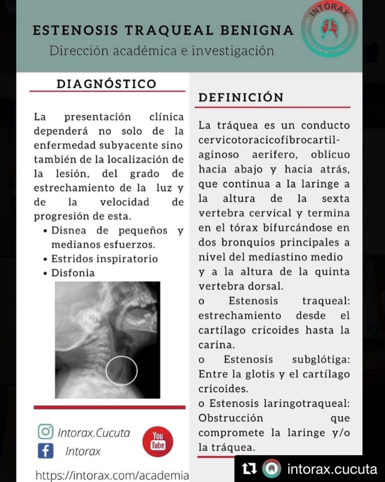 Píldora&nbsp;<img height="16" width="16" alt="💊" src="https://static.xx.fbcdn.net/images/emoji.php/v9/tf5/1/16/1f48a.png">&nbsp;académica de la semana<br>Contenido completo en&nbsp;<a href="http://www.intorax.com/academia?fbclid=IwAR2DDpNJTBDrOptl_fXU0RVame8tRDwFdDO2KWu_iG5Ggmtg21LVlvJ0JdM" rel="noreferrer noopener" target="_blank">www.intorax.com/academia</a><a href="https://web.facebook.com/hashtag/intoraxesdesarrollocienti%CC%81fico?__eep__=6&__cft__[0]=AZUp3x5wIwpn8INOlJjCGEvRM_33pUJdTP6pMtwYbC63xfzJ0xq7pEAdqnigPGf7T_9ni05MTDI_az5BmyHICzgy--AJcNJz12BMlwYZGtJa6wDZqTW0ksilafu_YAUW7-UlL6krTyhArWnZSgYiCOR-&__tn__=*NK*F">#intoraxesdesarrollocientífico</a><a href="https://web.facebook.com/hashtag/intoraxesacademia?__eep__=6&__cft__[0]=AZUp3x5wIwpn8INOlJjCGEvRM_33pUJdTP6pMtwYbC63xfzJ0xq7pEAdqnigPGf7T_9ni05MTDI_az5BmyHICzgy--AJcNJz12BMlwYZGtJa6wDZqTW0ksilafu_YAUW7-UlL6krTyhArWnZSgYiCOR-&__tn__=*NK*F">#intoraxesacademia</a>