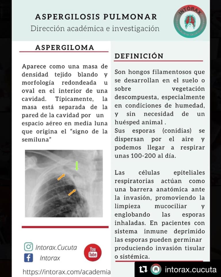 Píldora&nbsp;<img height="16" width="16" alt="💊" src="https://static.xx.fbcdn.net/images/emoji.php/v9/tf5/1/16/1f48a.png">&nbsp;académica de la semana<br>Más contenido en&nbsp;<a href="https://l.facebook.com/l.php?u=http%3A%2F%2Fwww.intorax.com%2F%3Ffbclid%3DIwAR0LoOKc-GFM7h0OgrwpWH-6N8-g7-mBg7YXbCevLpMgghdUEF1MeH2q-lk&h=AT2ctgD-C27mflNj9JqCaRgbACng4QpGv9YQqvY9ixvkYcNWLfvnXxTLniD79KiziLFsjjIVGNrmmEpO4FQdPFwR97ZMFIFgsAeHgdal4QmhtY1InJOBBQYYdQyuPKZDZkNE&__tn__=-UK*F&c[0]=AT04PoURMqpdW9NSDI44HNVJgE8UqiJRvrrtHnnHSMsRe1xfdPb9jdQq9yIZDQX-UGamdE47lBoBWnd39ucJZ7yXNNr0KqylINwSwX-YdcoWlWus_0UZhf1YzmCY1nl67DmjIV1D6ALfl3AAPH2LlWHkb99mczQr0x61NQ479Os7o8g" rel="noreferrer noopener" target="_blank">www.intorax.com</a>&nbsp;/ academia&nbsp;<a href="https://www.facebook.com/hashtag/intoraxacademico?__eep__=6&__cft__[0]=AZUV37uSoTakaaAr9Zk5WiJNBU7U_pGVp6zctK4kYZSZngkpHQgfMo-er09om31EO_rsH3Xbx7DzSgX470mzNiecSUAypsqV1qCNGlcBJmKo-ofITpw_gHE2WHSmm3YLZ8B9hBm6eTH1_3MC-aBivt34&__tn__=*NK*F">#intoraxacademico</a><a href="https://www.facebook.com/hashtag/intoraxesdesarrollocienti%CC%81fico?__eep__=6&__cft__[0]=AZUV37uSoTakaaAr9Zk5WiJNBU7U_pGVp6zctK4kYZSZngkpHQgfMo-er09om31EO_rsH3Xbx7DzSgX470mzNiecSUAypsqV1qCNGlcBJmKo-ofITpw_gHE2WHSmm3YLZ8B9hBm6eTH1_3MC-aBivt34&__tn__=*NK*F">#intoraxesdesarrollocientífico</a>