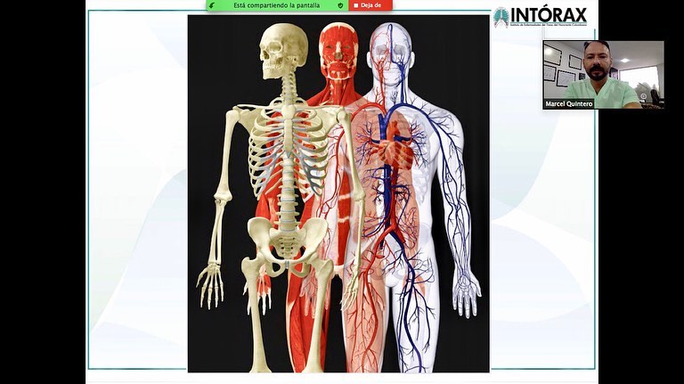 CLASE:”INDUCCIÓN A LA CIRUGÍA TORÁCICA” Y LANZAMIENTO DEL 1 SIMPOSIO DE CIRUGÍA TORÁCICA, Estudiantes VIII Semestre UPA(12/01/2021). @intorax.cucuta @unipamplona @departamentodemedicina @1ersimposiocxtorax<a href="https://www.facebook.com/Intorax-142885062440452/photos/pcb.3677223392339917/3677223195673270/?__cft__[0]=AZUwaUD5PIZryfIayUt9vbAVq6hPTTd8VYmwwzlh3TsFRxT6P8Hqz988v_IO-1zf2-3D-cQ8ZYKaacgXy69Wq7zxOE7AoB4xyaZYn6OkjF8LWz86KFV1rG872rm7VYR3EAMwx0xtANOBcm7A2UFws8Zi&__tn__=*bH-R"></a><a href="https://www.facebook.com/Intorax-142885062440452/photos/pcb.3677223392339917/3677223179006605/?__cft__[0]=AZUwaUD5PIZryfIayUt9vbAVq6hPTTd8VYmwwzlh3TsFRxT6P8Hqz988v_IO-1zf2-3D-cQ8ZYKaacgXy69Wq7zxOE7AoB4xyaZYn6OkjF8LWz86KFV1rG872rm7VYR3EAMwx0xtANOBcm7A2UFws8Zi&__tn__=*bH-R"></a><a href="https://www.facebook.com/Intorax-142885062440452/photos/pcb.3677223392339917/3677223185673271/?__cft__[0]=AZUwaUD5PIZryfIayUt9vbAVq6hPTTd8VYmwwzlh3TsFRxT6P8Hqz988v_IO-1zf2-3D-cQ8ZYKaacgXy69Wq7zxOE7AoB4xyaZYn6OkjF8LWz86KFV1rG872rm7VYR3EAMwx0xtANOBcm7A2UFws8Zi&__tn__=*bH-R"></a><a href="https://www.facebook.com/Intorax-142885062440452/photos/pcb.3677223392339917/3677223175673272/?__cft__[0]=AZUwaUD5PIZryfIayUt9vbAVq6hPTTd8VYmwwzlh3TsFRxT6P8Hqz988v_IO-1zf2-3D-cQ8ZYKaacgXy69Wq7zxOE7AoB4xyaZYn6OkjF8LWz86KFV1rG872rm7VYR3EAMwx0xtANOBcm7A2UFws8Zi&__tn__=*bH-R">+6</a>