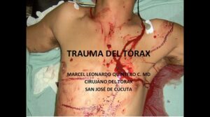 CLASE:” TRAUMA DE TÓRAX, 2021 PRIMER SEMESTRE” Estudiantes VIII UPA, IX UNIBOSQUE 12/02/3021. @intorax.cucuta @unipamplona @departamentodemedicina @uelbosque