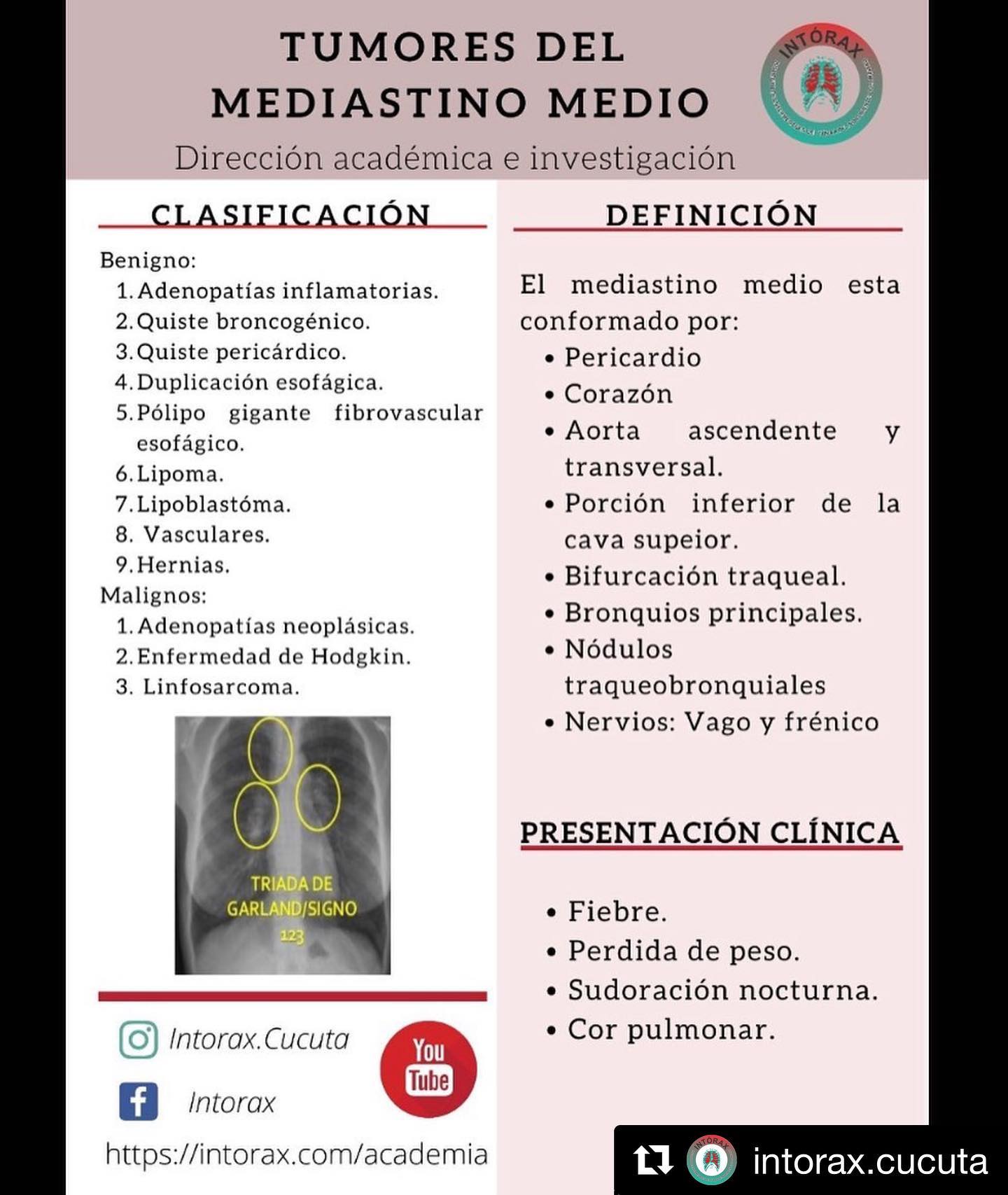 Píldora&nbsp;<img height="16" width="16" alt="💊" src="https://static.xx.fbcdn.net/images/emoji.php/v9/tf5/1/16/1f48a.png">&nbsp;académica de la semana<br>Más información disponible en&nbsp;<a href="https://l.facebook.com/l.php?u=http%3A%2F%2Fwww.intorax.com%2F%3Ffbclid%3DIwAR2EcU7wKEHVvlvTjDUr2-GKLNC5Ffavc-NYaxsf4U6iK_L1jcP5-K9AfR0&h=AT3pNdkr0XofSQklNReWT590JKDBI7MZ4hItzAuBwPrcZYkQs2t8vdUagHi8oLt_xqgbPwAJTgsndsq75T5WoPv1YslaZS7POPu49IvSDV0NbP4K5SOMVXjPdUrFtfNSMT-7&__tn__=-UK*F&c[0]=AT3riThybACMD045Mnua-576g-LbYb1Mi4sRINLrsQ9T28l0L90WmLSBbhZdLk-jerulLD33TFtFQ14HvX2N1YjXxWHPURfCRj0jk1cedGVcoR79ocERIRJjZeyN0XctC_folFm8TPqTjx-g4LkkoJNl1nl_lEIyxCDSIKlCQ9E3-38" rel="noreferrer noopener" target="_blank">www.intorax.com</a>&nbsp;/ academia&nbsp;<a href="https://web.facebook.com/hashtag/intoraxesdesarrollocient%C3%ADfico?__eep__=6&__cft__[0]=AZXdOjfQupCnp9RSLS_6M0J8ZD6mnLlMdJ056Kjkc3-8yC9ce5CYprGldUPNyZ_jbyJFE5QFwfyZiwTVuXA8DxArpLyzUMOR9smr2ipgRPOIgCI6bY-hgZhKoLG9pOv0DS6eprzRJRxZXScNz4lVE_Qt&__tn__=*NK*F">#intoraxesdesarrollocientífico</a><a href="https://web.facebook.com/hashtag/intoraxacademico?__eep__=6&__cft__[0]=AZXdOjfQupCnp9RSLS_6M0J8ZD6mnLlMdJ056Kjkc3-8yC9ce5CYprGldUPNyZ_jbyJFE5QFwfyZiwTVuXA8DxArpLyzUMOR9smr2ipgRPOIgCI6bY-hgZhKoLG9pOv0DS6eprzRJRxZXScNz4lVE_Qt&__tn__=*NK*F">#intoraxacademico</a>&nbsp;@intorax.cucuta