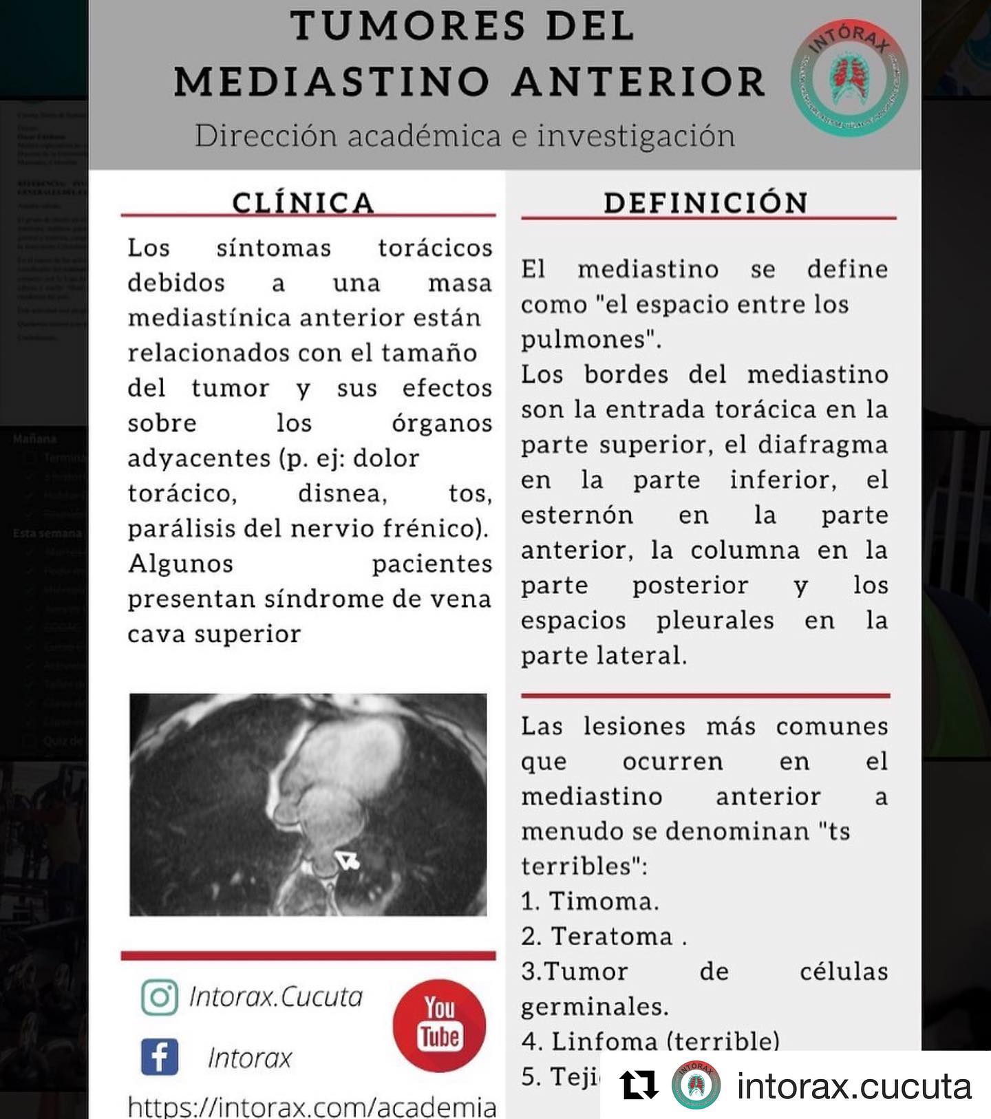 Píldora&nbsp;<img height="16" width="16" alt="💊" src="https://static.xx.fbcdn.net/images/emoji.php/v9/tf5/1/16/1f48a.png">&nbsp;académica de la semana<br>Más contenido en&nbsp;<a href="http://www.intorax.com/?fbclid=IwAR2Vz5AVaTPNi1Eqv3mzSQRlOEluKh2rT00UFkQgXtDsMltIld5vI6vQFNo" rel="noreferrer noopener" target="_blank">www.intorax.com</a>&nbsp;/ academia.&nbsp;<a href="https://web.facebook.com/hashtag/intoraxesdesarrollocient%C3%ADfico?__eep__=6&__cft__[0]=AZWLMn5Op7LRtIaQm9g-GmRokpqVEITGjRSB5B2aVcYpn8G5gfRx1PQy6ID52rxheeqfMWGB90cah8WKtNiE1yZKw_BA49oRu4Ldq_n5__7ywoSx8GOySthynQIlWGnHwUlsnQH5Y216S3WDFIJamUql&__tn__=*NK*F">#intoraxesdesarrollocientífico</a><a href="https://web.facebook.com/hashtag/intoraxacademico?__eep__=6&__cft__[0]=AZWLMn5Op7LRtIaQm9g-GmRokpqVEITGjRSB5B2aVcYpn8G5gfRx1PQy6ID52rxheeqfMWGB90cah8WKtNiE1yZKw_BA49oRu4Ldq_n5__7ywoSx8GOySthynQIlWGnHwUlsnQH5Y216S3WDFIJamUql&__tn__=*NK*F">#intoraxacademico</a>&nbsp;@intorax.cucuta