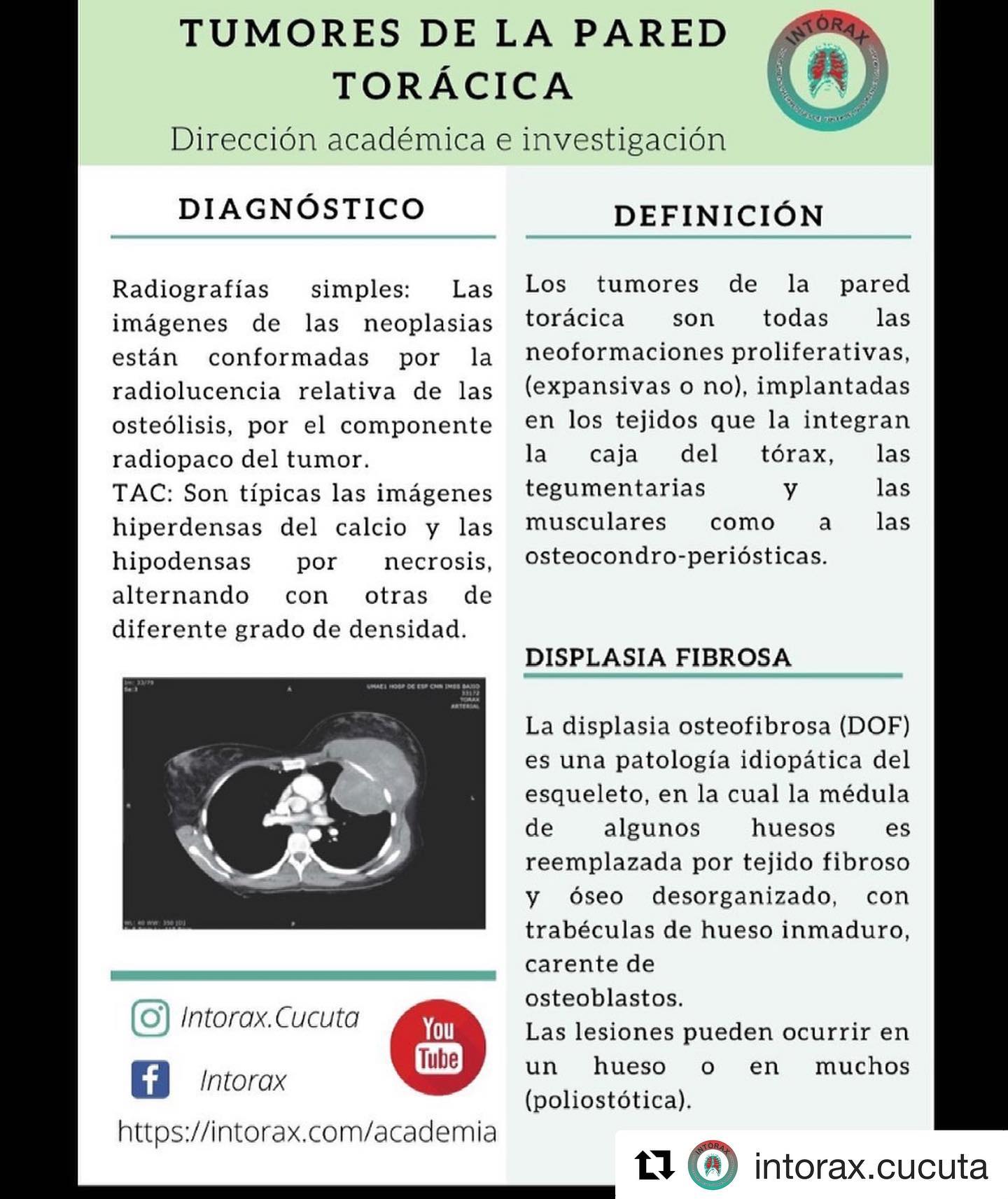 Píldora 💊 académica de la semana: La presentación con más contenido esta disponible en www.intorax.com / academia. #intoraxesdesarrollocientífico #intoraxacademico @intorax.cucuta