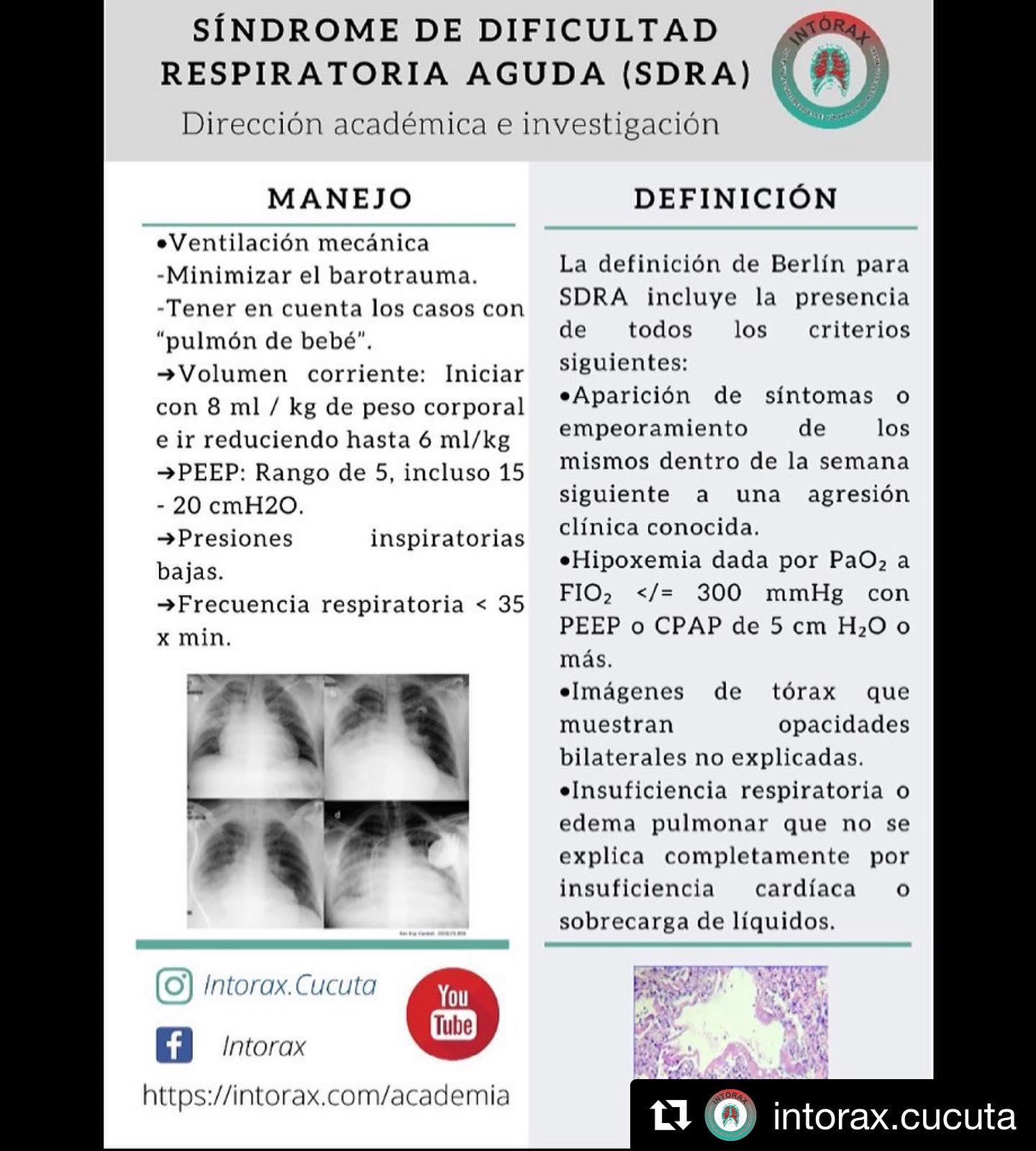 Píldora 💊 académica de la semana, SDRA: La presentación esta disponible en www.intorax.com / academia #intoraxesdesarrollocientífico #intoraxacademico @intorax.cucuta