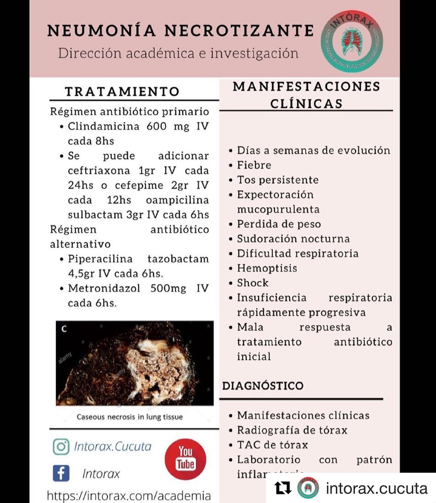 Píldora&nbsp;<img height="16" width="16" alt="💊" src="https://static.xx.fbcdn.net/images/emoji.php/v9/tf5/1/16/1f48a.png">&nbsp;académica de la semana<br>La información completa en&nbsp;<a href="https://l.facebook.com/l.php?u=http%3A%2F%2Fwww.intorax.com%2F%3Ffbclid%3DIwAR3_XLsoUXqaIOXHK9LqxV5xRKEQbDMNUW2jmlrZHbf2nUr8Uk46GpmaR1Q&h=AT1iFnBHx_Uz_0yUC7W-2-AhUurlt6vT6pJSetKG8saIn6m5DhuNT4sYLt5PEjv3WR35r7iIcfr5YAQvveIwar6ovc63M21Y2A8SvC2zeVDmtA2NBFoXmrqR-zvLuzroazne&__tn__=-UK*F&c[0]=AT1B4T0yq5Qgs7v53_3re6pXiqTXu16WAfATxJpZN2sKrDtki-wSrLekYvD3SPG_d_x2gUzkJjmILMuaZKxg5G4axA_kJX-GjkLBZOnh8RpVFC4rgr61zEfHo7npn1gmYEThamabMZvW7vPx-1ld0guIAOtmBBYiNVZTvDJBqWJzOdI" rel="noreferrer noopener" target="_blank">www.intorax.com</a>&nbsp;/ academia&nbsp;<a href="https://web.facebook.com/hashtag/intoraxesdesarrollocient%C3%ADfico?__eep__=6&__cft__[0]=AZUwfC-oFzsg1rS1Y29h35Pi6N6hmomfpuuEjjrfOZC0ji0-s16O0rEqH5SsgDU2QmhecIMujG1rZWNEPjUGMN6WqR31LmSYq7ri0geQfIX7zWvyiUtq_eMcEAZwF6ZkeRaGcm9F_eXqGhfVRbKvuUN-&__tn__=*NK*F">#intoraxesdesarrollocientífico</a><a href="https://web.facebook.com/hashtag/intoraxacademico?__eep__=6&__cft__[0]=AZUwfC-oFzsg1rS1Y29h35Pi6N6hmomfpuuEjjrfOZC0ji0-s16O0rEqH5SsgDU2QmhecIMujG1rZWNEPjUGMN6WqR31LmSYq7ri0geQfIX7zWvyiUtq_eMcEAZwF6ZkeRaGcm9F_eXqGhfVRbKvuUN-&__tn__=*NK*F">#intoraxacademico</a>&nbsp;@intorax.cucuta—&nbsp;en&nbsp;<strong><a href="https://web.facebook.com/C%C3%BAcuta-106053542767900/?__cft__[0]=AZUwfC-oFzsg1rS1Y29h35Pi6N6hmomfpuuEjjrfOZC0ji0-s16O0rEqH5SsgDU2QmhecIMujG1rZWNEPjUGMN6WqR31LmSYq7ri0geQfIX7zWvyiUtq_eMcEAZwF6ZkeRaGcm9F_eXqGhfVRbKvuUN-&__tn__=kC*F">Cúcuta</a></strong>.