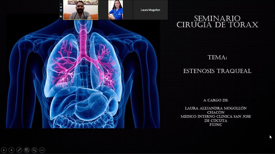 SEMINARIO: “ESTENOSIS TRAQUEAL” Internado Especial FUJNCClínica San José de Cúcuta 24/05/2021. @intorax.cucuta @laura_alejandraa11 @unicorpas