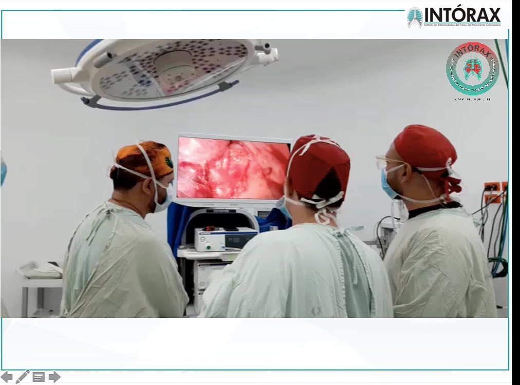 “INTRODUCCIÓN A LA CIRUGÍA TORÁCICA” Clase Estudiantes VIII semestre UPA; 12 de Julio 2021. @intorax.cucuta @unipamplona @departamentodemedicina