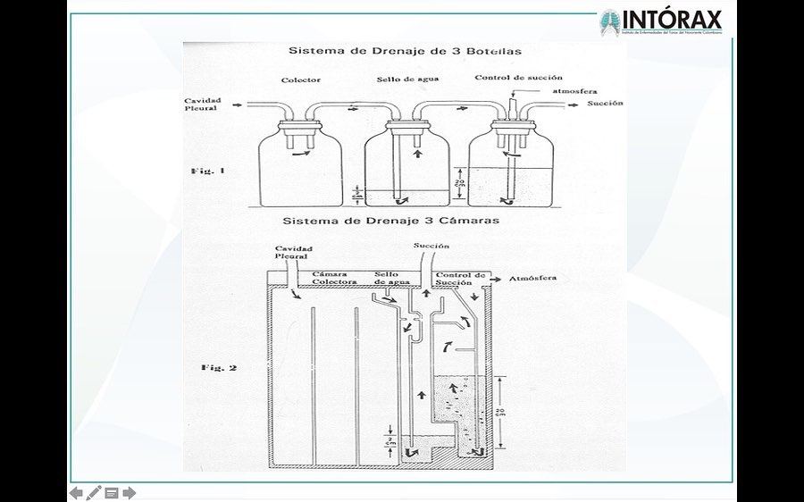 CLASE: “SISTEMAS SE DRENAJE PLEURAL” Estudiantes de VIII Semestre UPA, 13 de agosto 2021. @intorax.cucuta @unipamplona @departamentodemedicina
