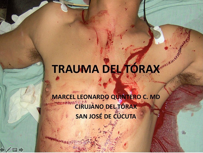 CLASE: “TRAUMA DE TÓRAX” Estudiantes de VIII Semestre UPA, 3 de Septiembre 2021. @intorax.cucuta @unipamplona @departamentodemedicina