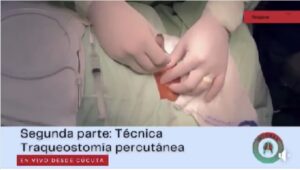 Nuestra píldora de la semana, nos invita a participar en nuestro I Simposio #Respirar, que se desarrollará el próximo 29 de octubre en la ciudad de Cúcuta. Inscripciones en la BIO￼￼￼￼